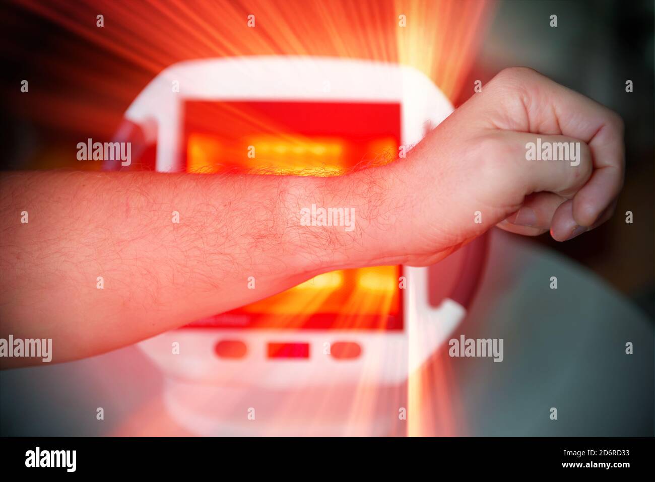 Hombre tratando el dolor en la mano con terapia de luz infrarroja. El  hombre se sienta en la mesa cerca de la lámpara curativa Fotografía de  stock - Alamy