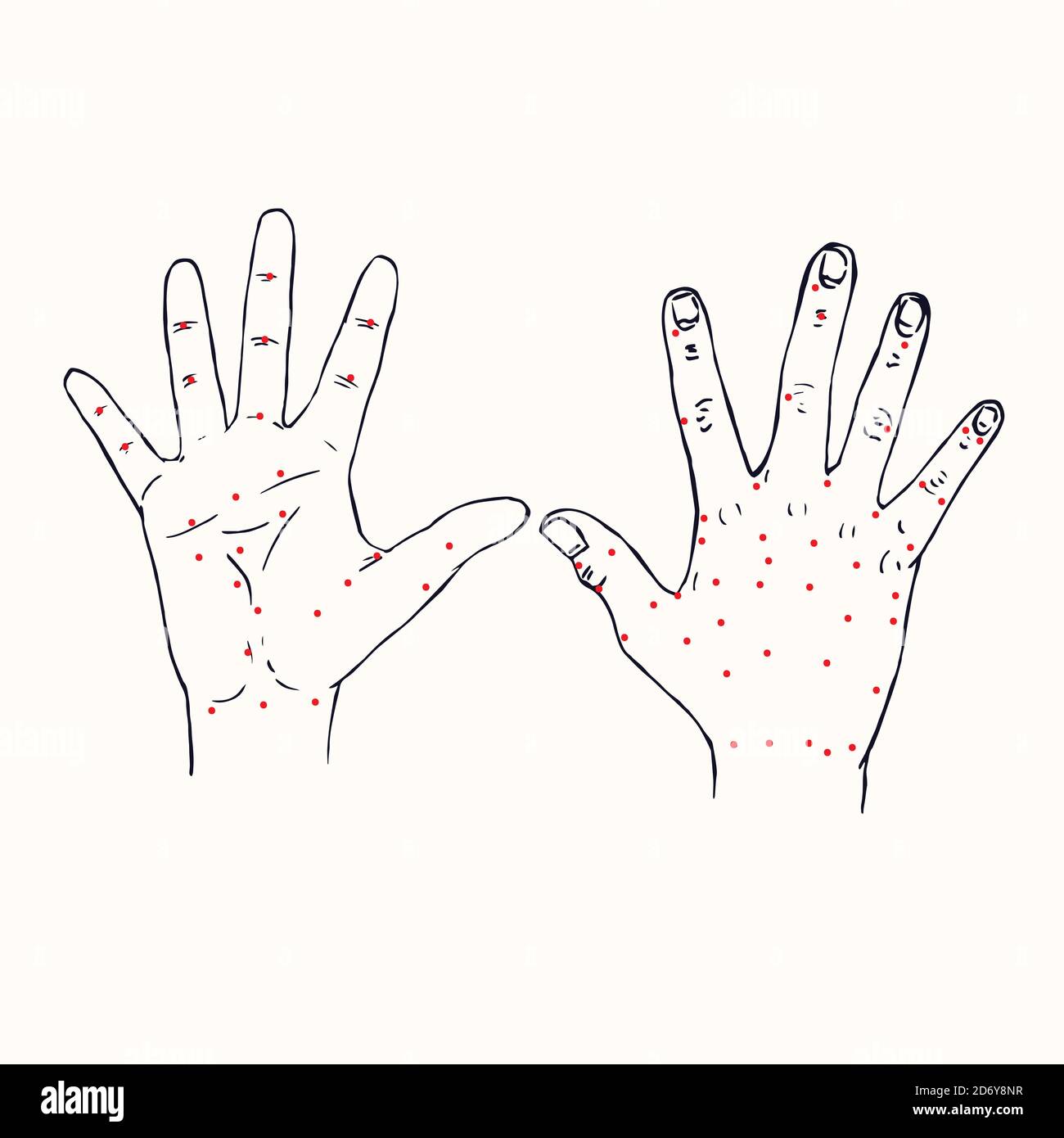 Manos (palma y dorsum de la mano derecha) Esquema de acupuntura China con  puntos rojos, tallarines dibujados a mano, boceto en estilo pop art,  medicina en blanco y negro Fotografía de stock -