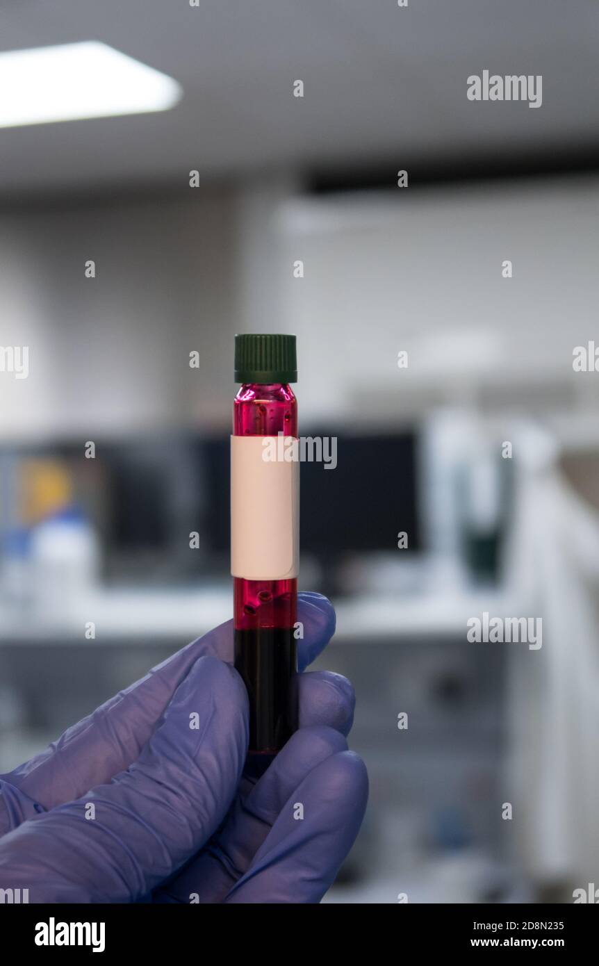 Científico en un laboratorio que sostiene un pequeño vial para un análisis de sangre. Pandemia mundial de Covid-19 Foto de stock