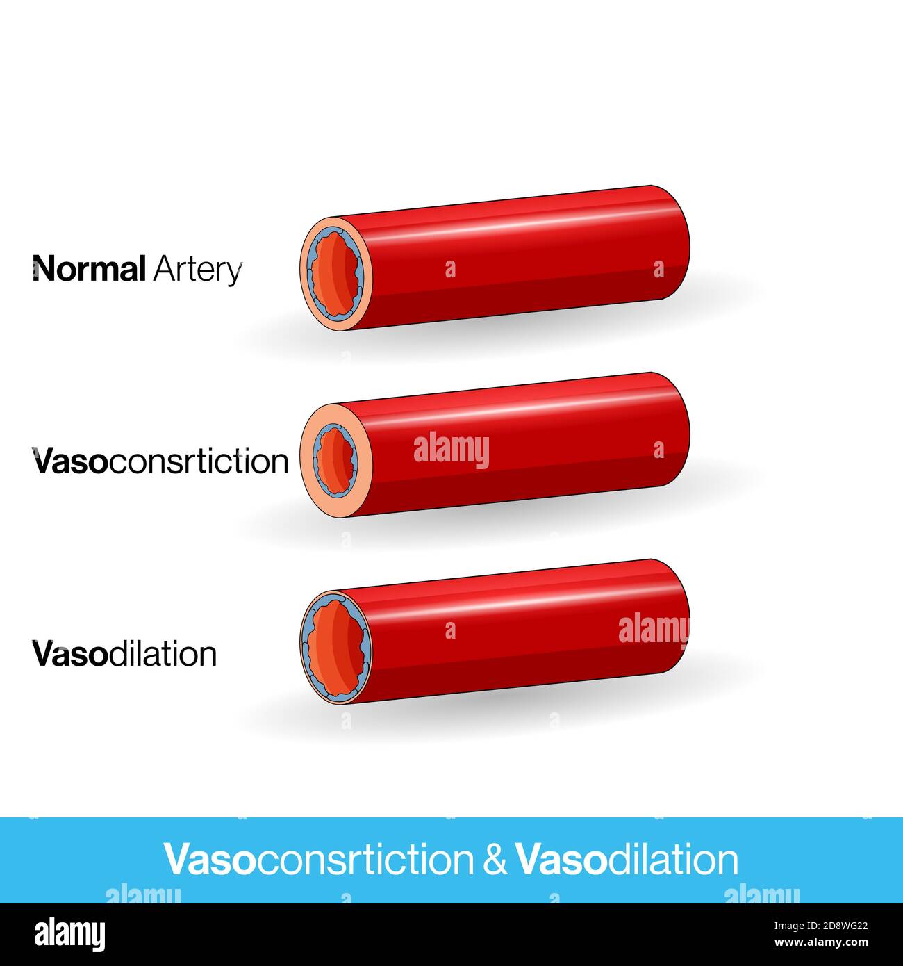 Vasos sanguíneos o capilares o arteria que muestran vasoconstricción y