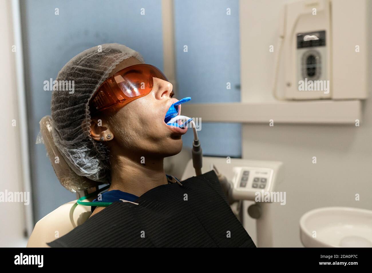 Mujer En Gafas De Seguridad Conseguir Un Procedimiento De Depilación Láser  Eliminación De Bigote Foto de stock y más banco de imágenes de Adulto -  iStock