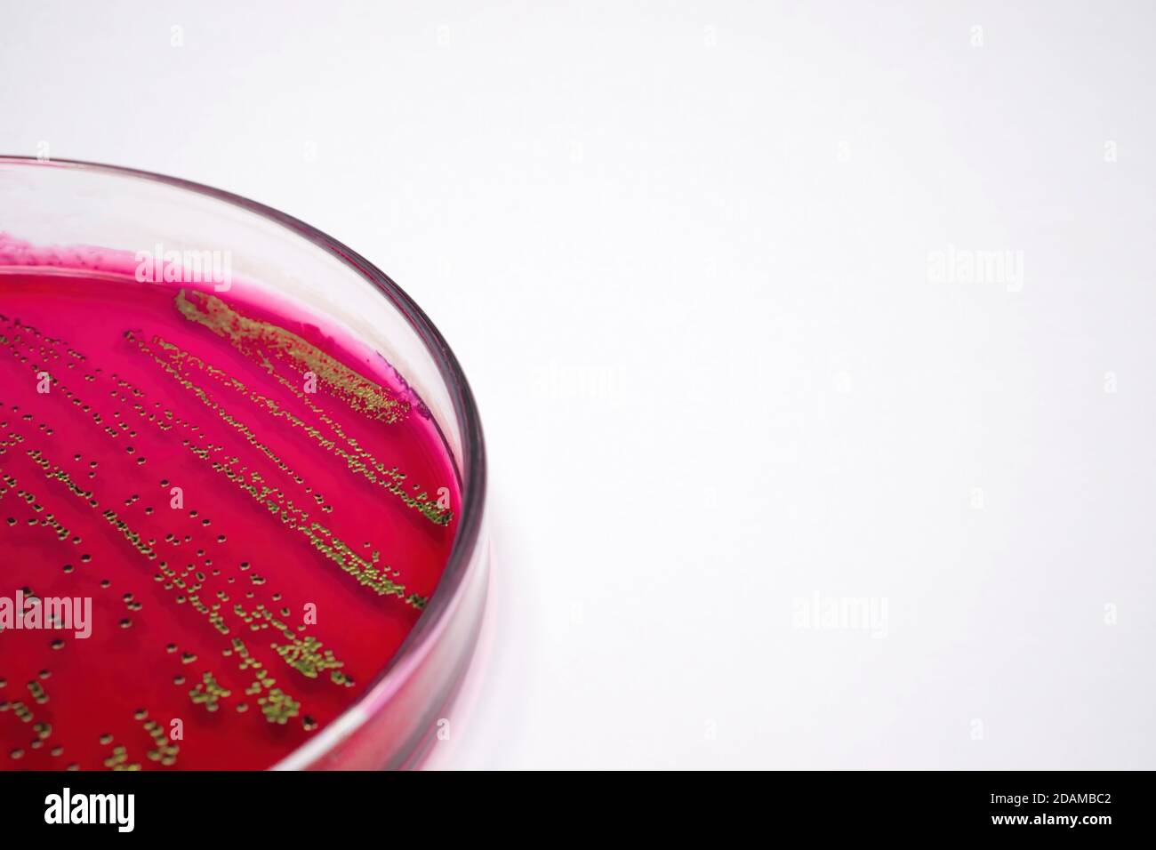 Bacterias Escherichia coli en medios selectivos de agar sangre. Foto de stock