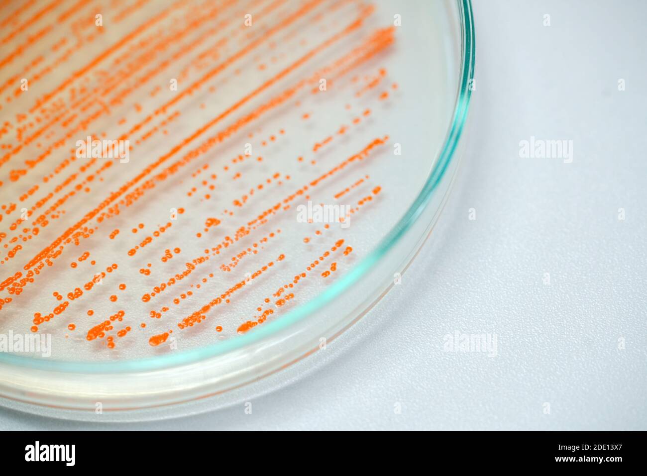 Colonia de bacterias en medio de cultivo Fotografía de stock - Alamy