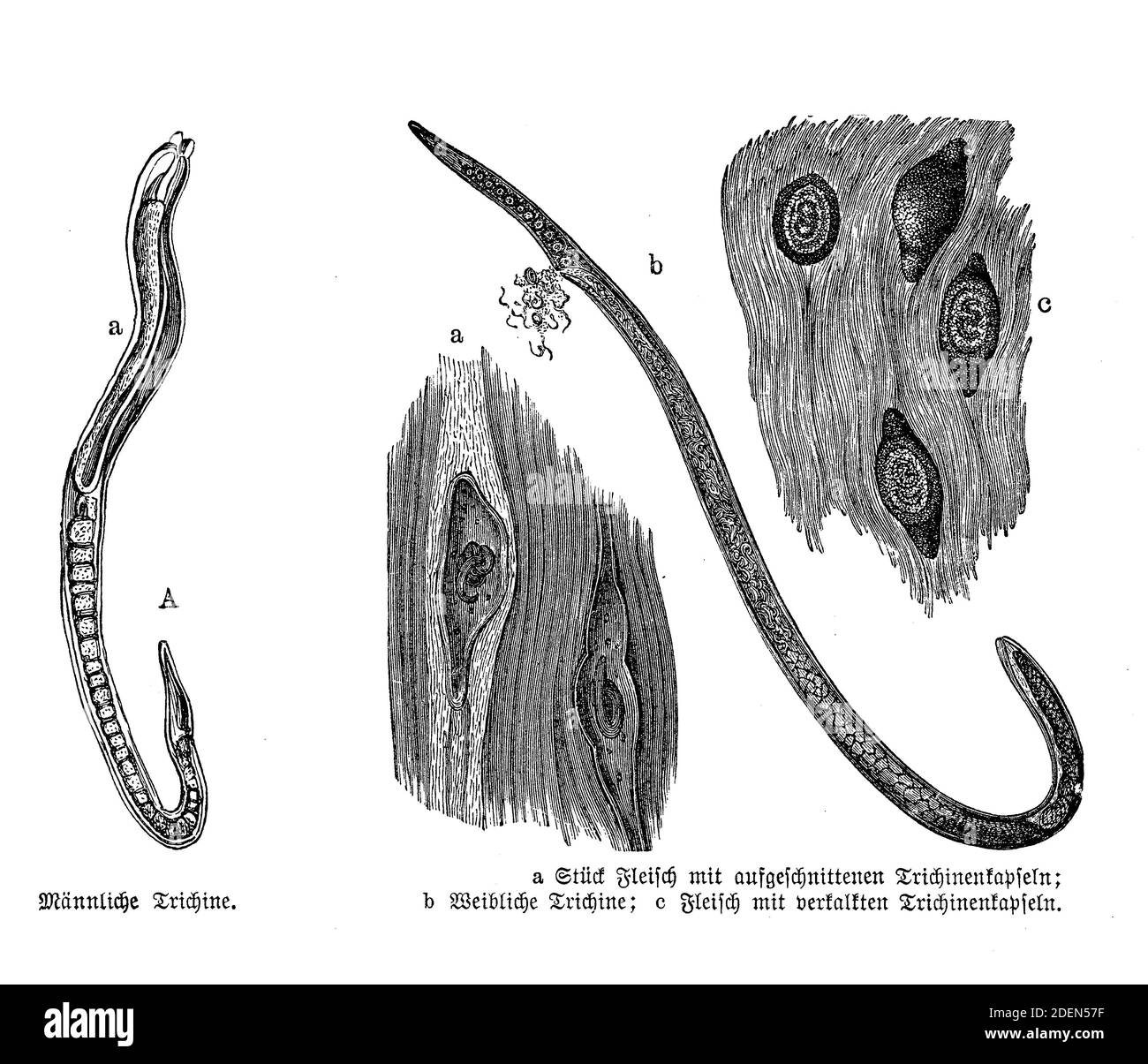 Trichinella spiralis, parásito responsable de la enfermedad trichinosis. Conocido como gusano de cerdo debido a que se encuentra en productos de cerdo poco cocidos, ilustración del siglo 19 Foto de stock