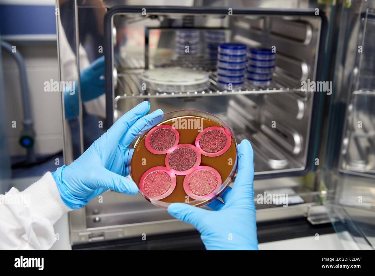 Análisis de superficie de laboratorio, hongos dermatofitos, Foto de stock