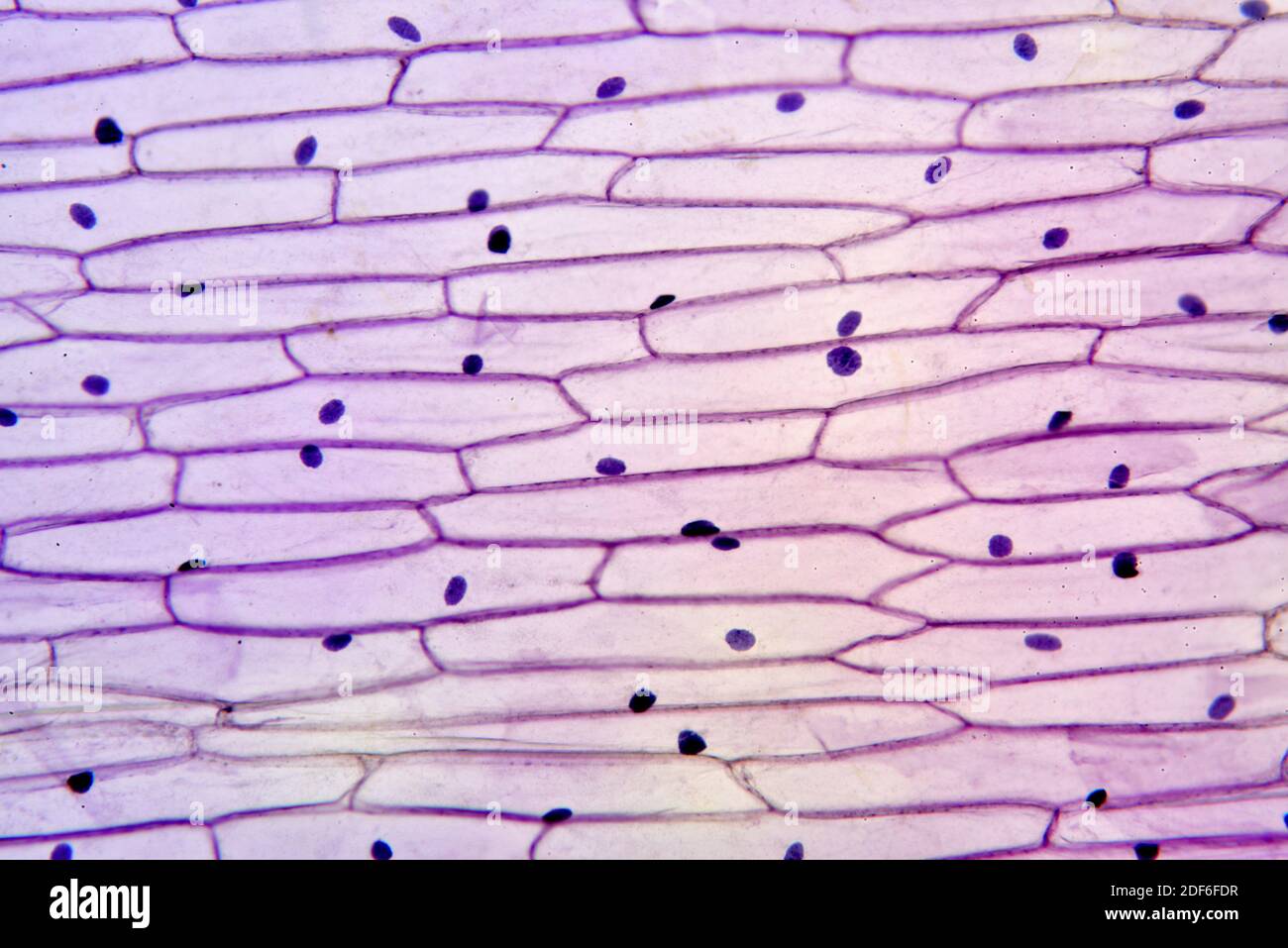 Epidermis de cebolla (Allium cepa) que muestra células y núcleo. Microscopio  óptico X100 Fotografía de stock - Alamy