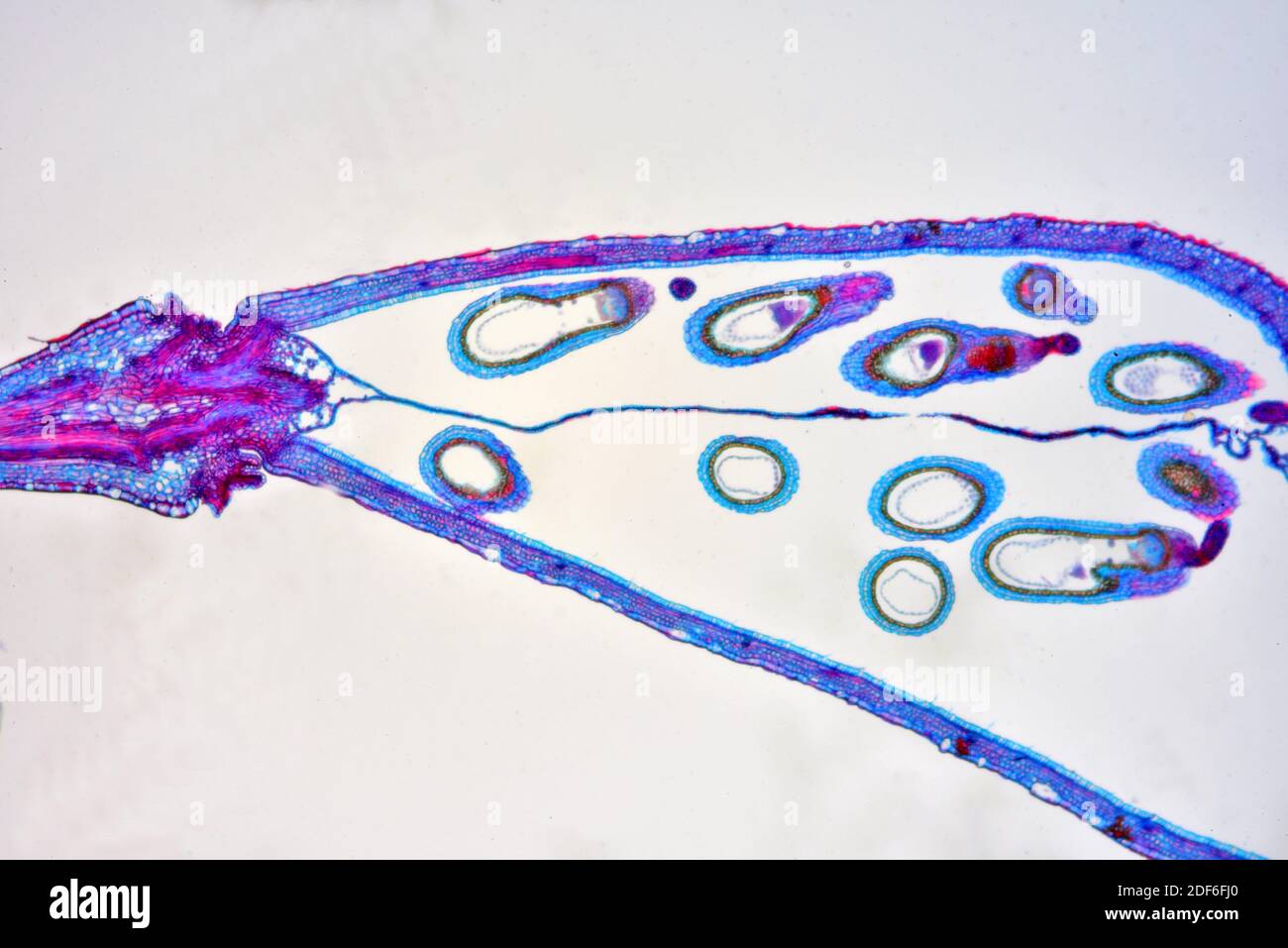 Ovario con embriones de bolso de pastor (Capsella bursa-pastoris). Microscopio óptico X40. Foto de stock