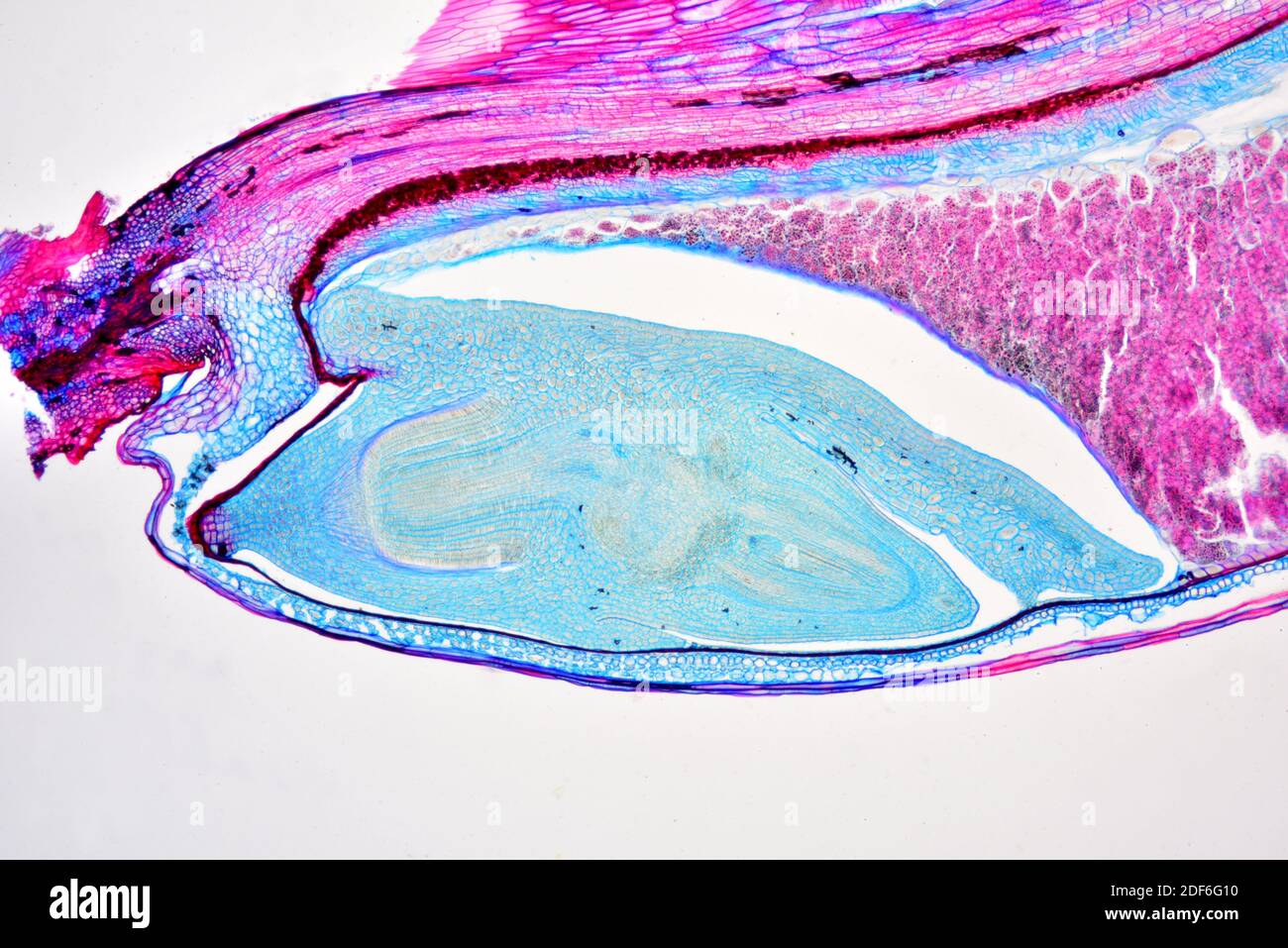 Germen de triticum con endosperma. Microscopio óptico X40. Foto de stock