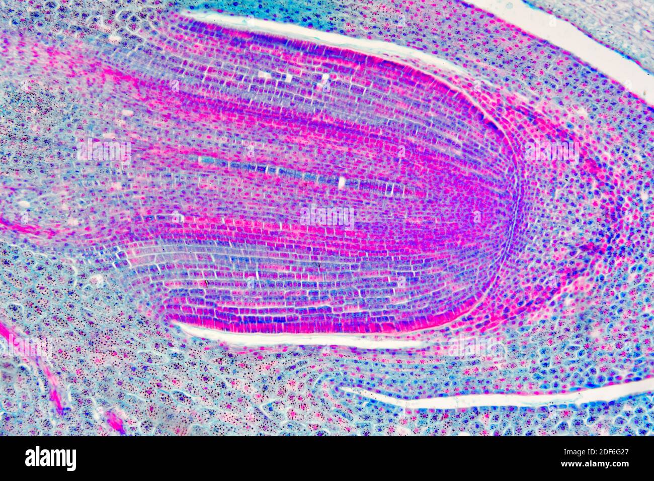 Germen de triticum con endosperma. Microscopio óptico X100. Foto de stock