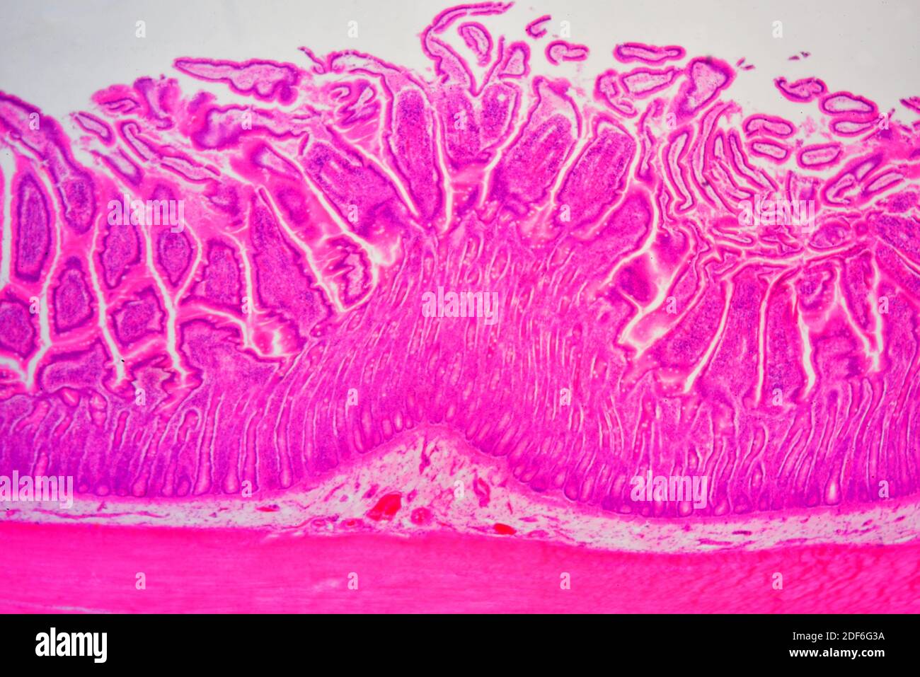 Glándulas de brunner fotografías e imágenes de alta resolución Alamy