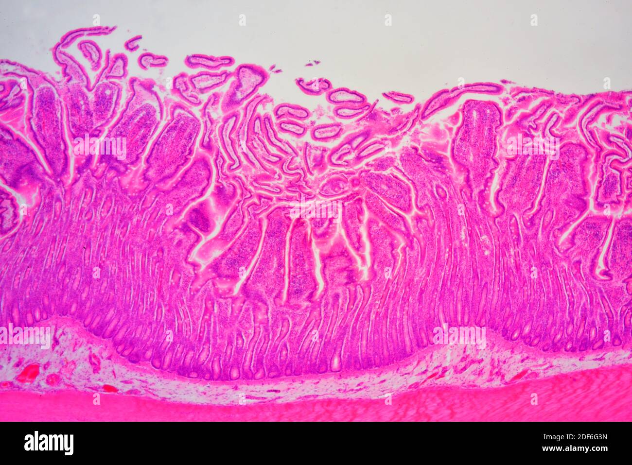 Sección transversal del intestino delgado que muestra mucosa, submucosa