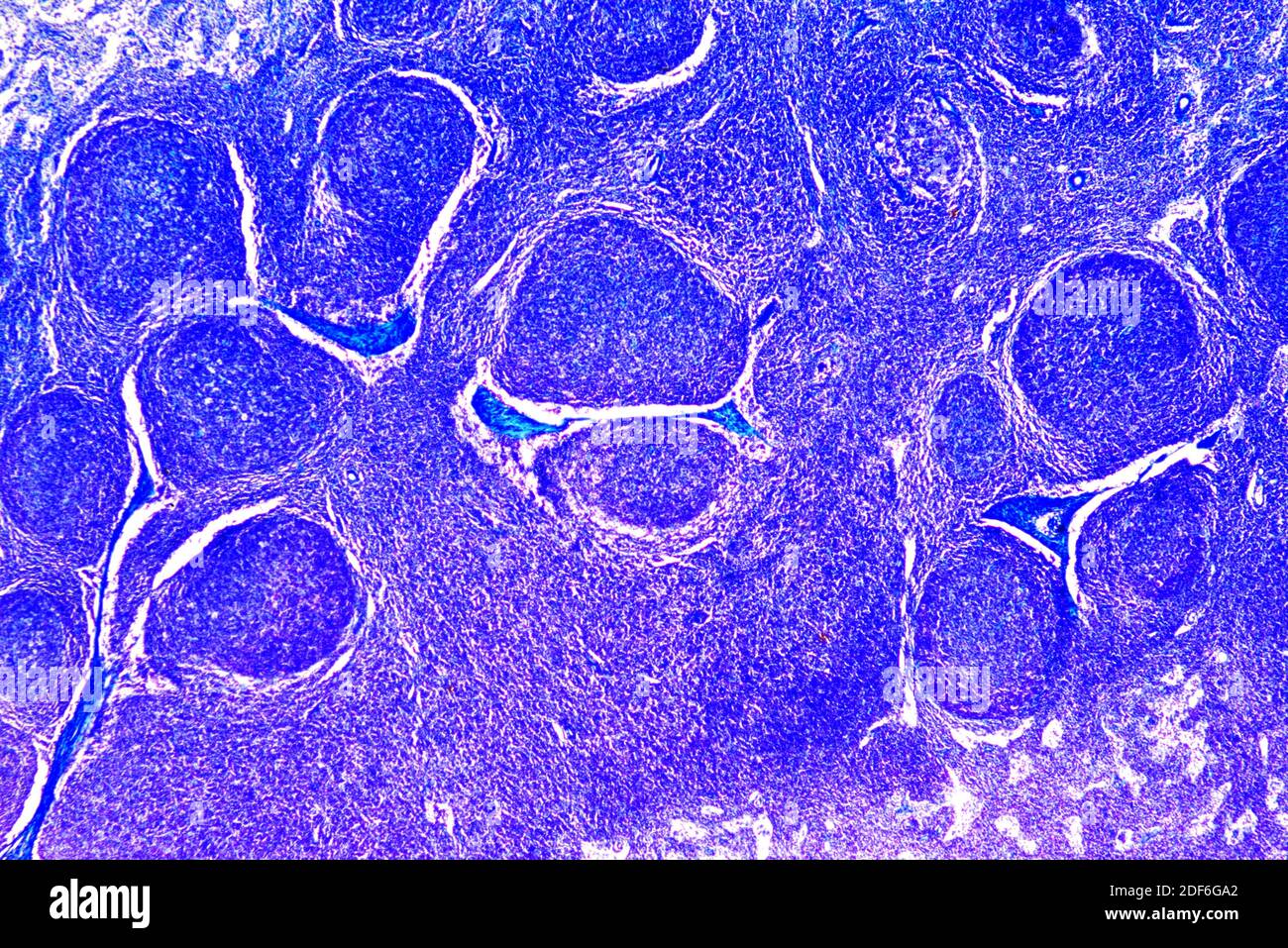 Glándula linfática normal humana. Microscopio óptico X40 Fotografía de  stock - Alamy