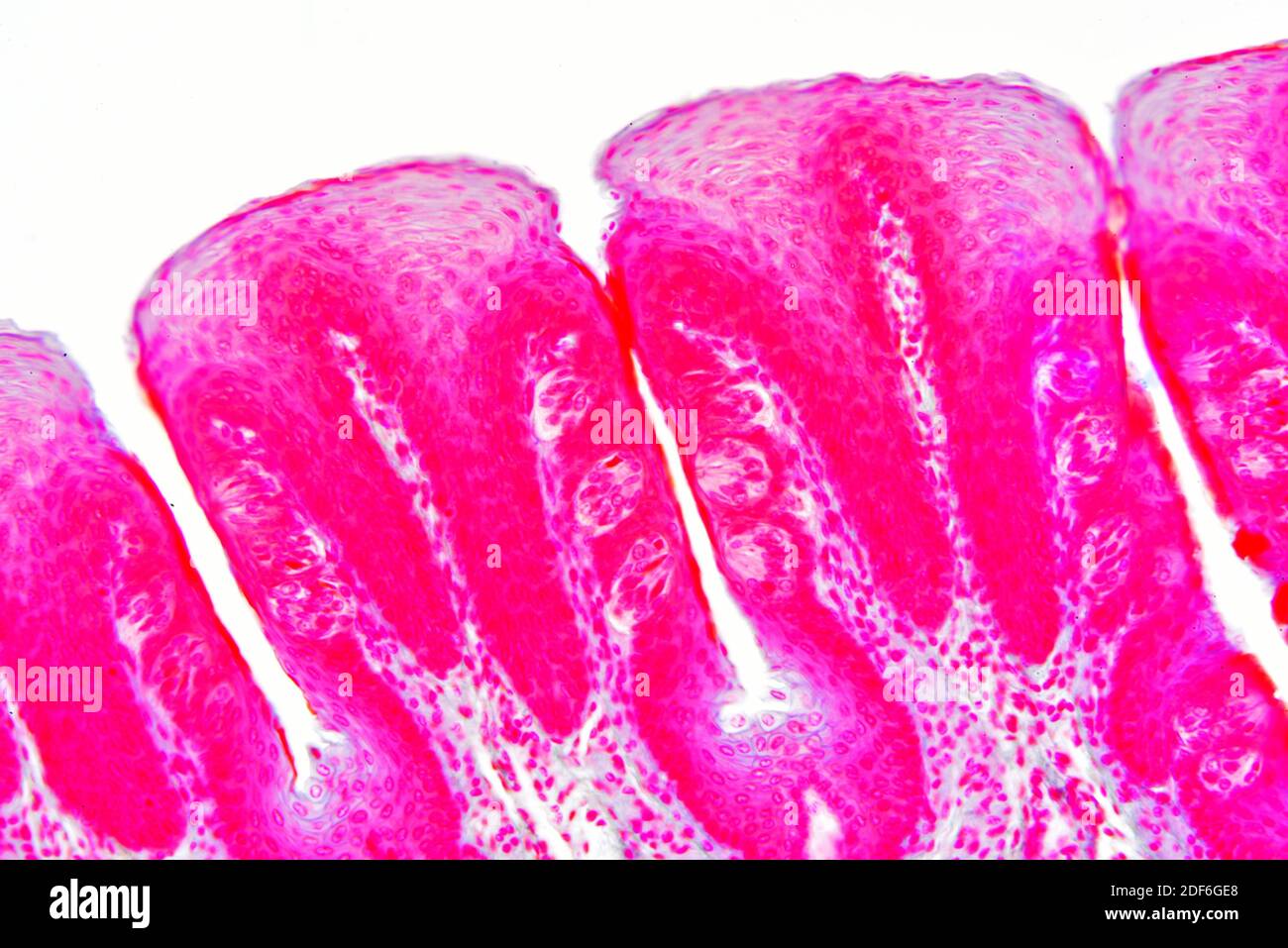 Sección de la lengua que muestra las papilas gustativas y el epitelio. Microscopio óptico X200. Foto de stock