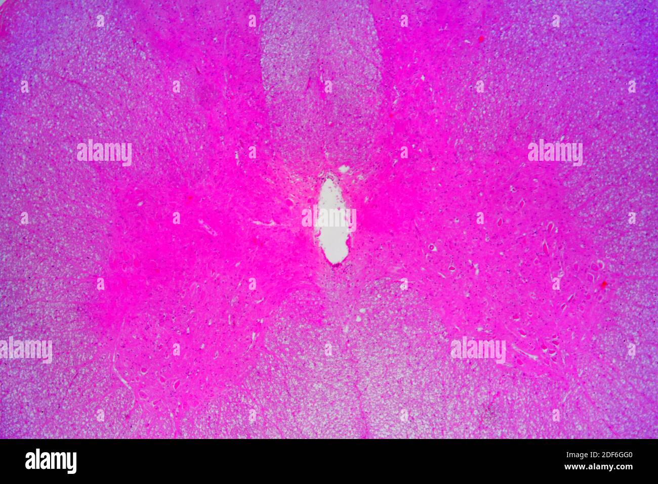 Médula espinal (tejido nervioso) que muestra materia ependimosa y gris. Microscopio óptico X100. Foto de stock
