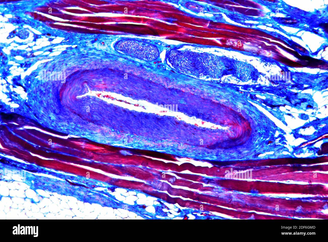 Arteria (vaso sanguíneo). Microscopio óptico X100. Foto de stock