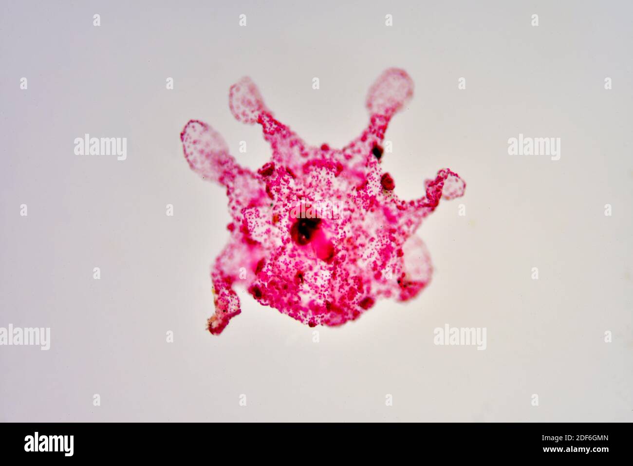 Aurelia aurita, ephyra larva. Microscopio óptico X100. Foto de stock