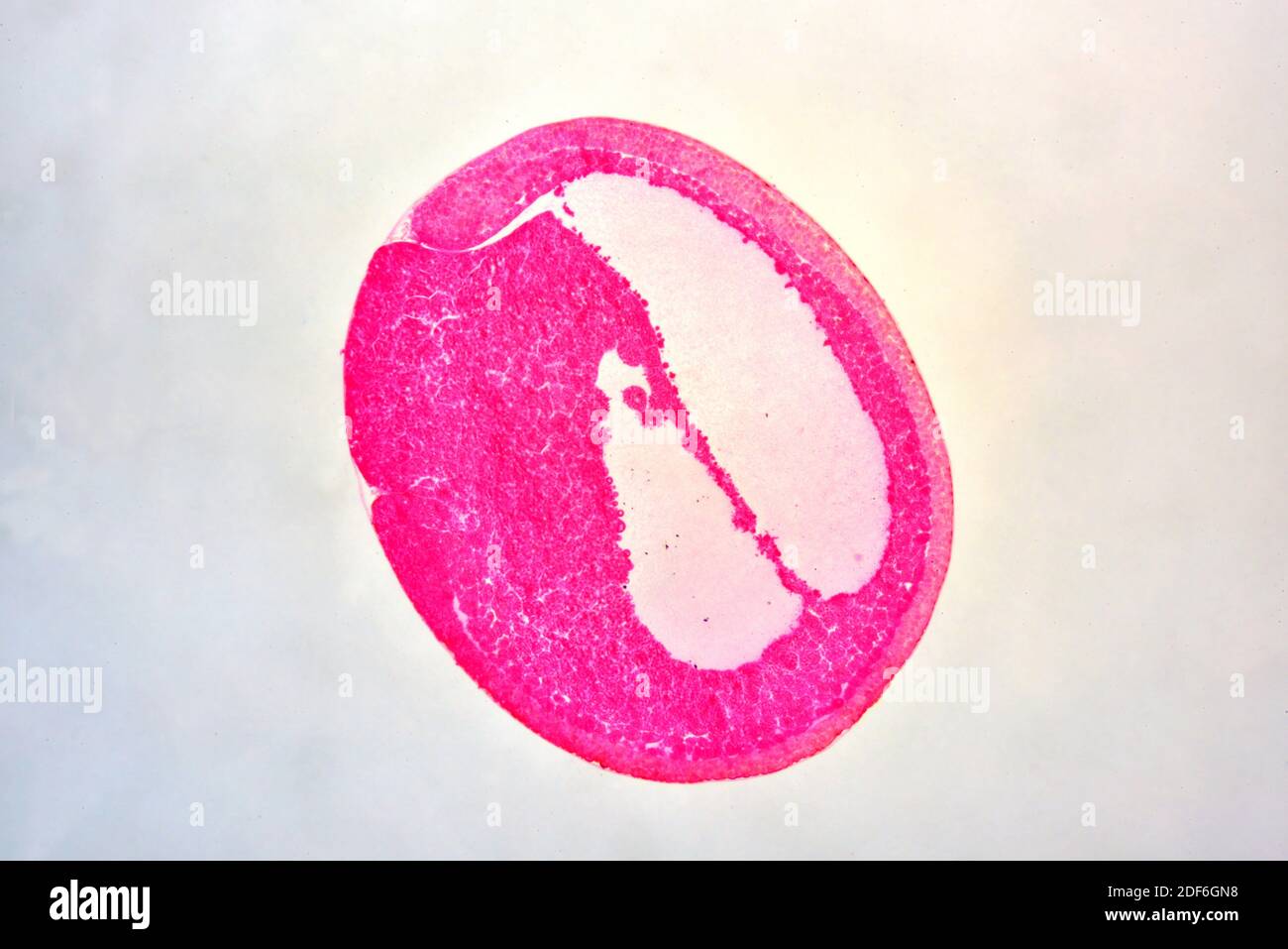 Embrión de rana (gastrula). Microscopio óptico X40. Foto de stock