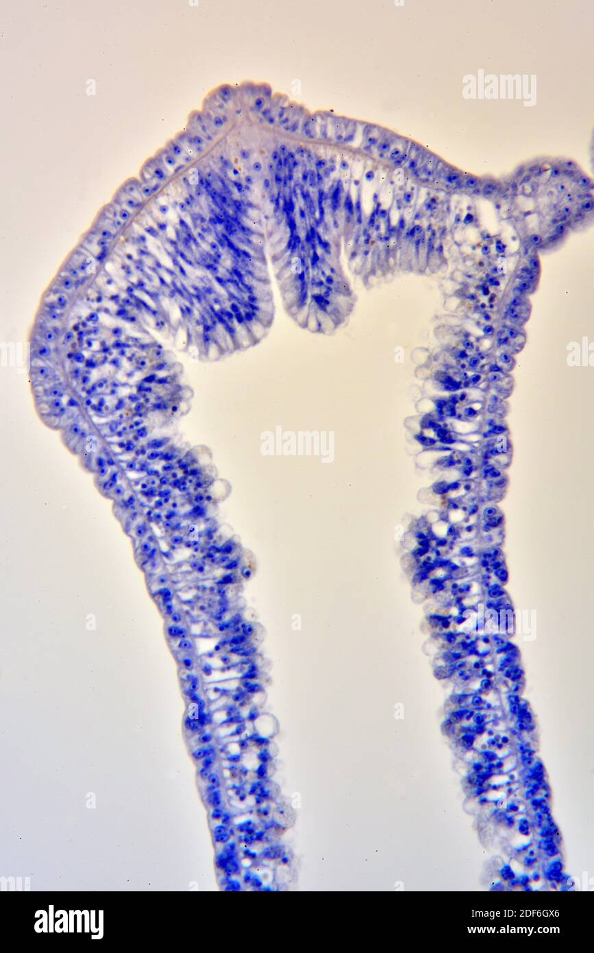 Hydra, sección longitudinal que muestra ectodermo, endodermo y cavidad gastrovascular. Microscopio óptico X200. Foto de stock