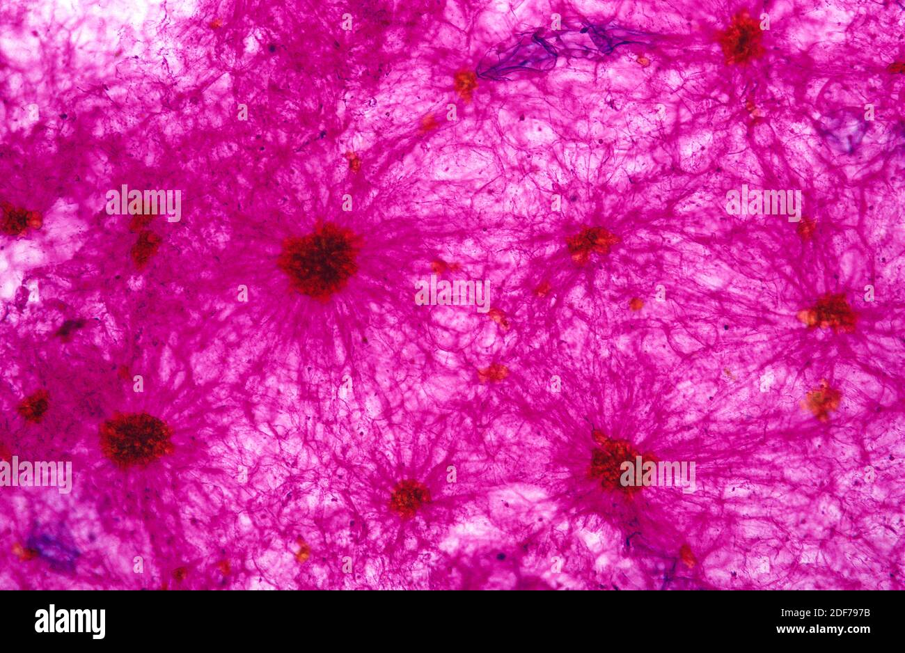 Los esclereidos son una especie de esclerenquimma, un tejido vegetal de apoyo. Fotomicrografía de pera. Foto de stock