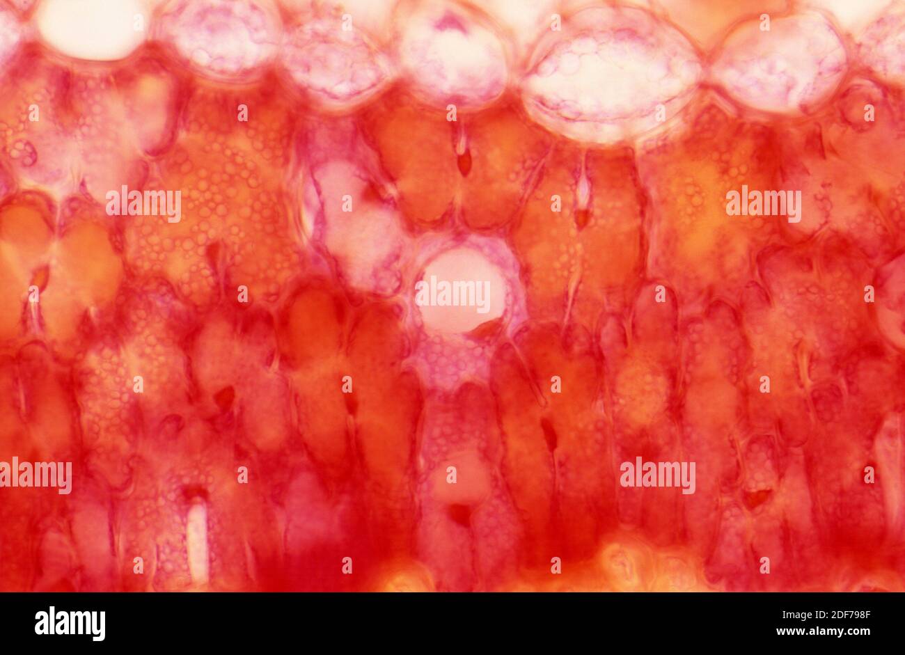 resina chanel en tejido de Pinus sp. Fotomicrografía. Foto de stock