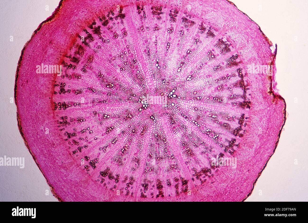 Estructura de la raíz de dicotiledón, sección transversal que muestra epidermis, parénquima, flóem y xilema. Fotomicrografía. Foto de stock
