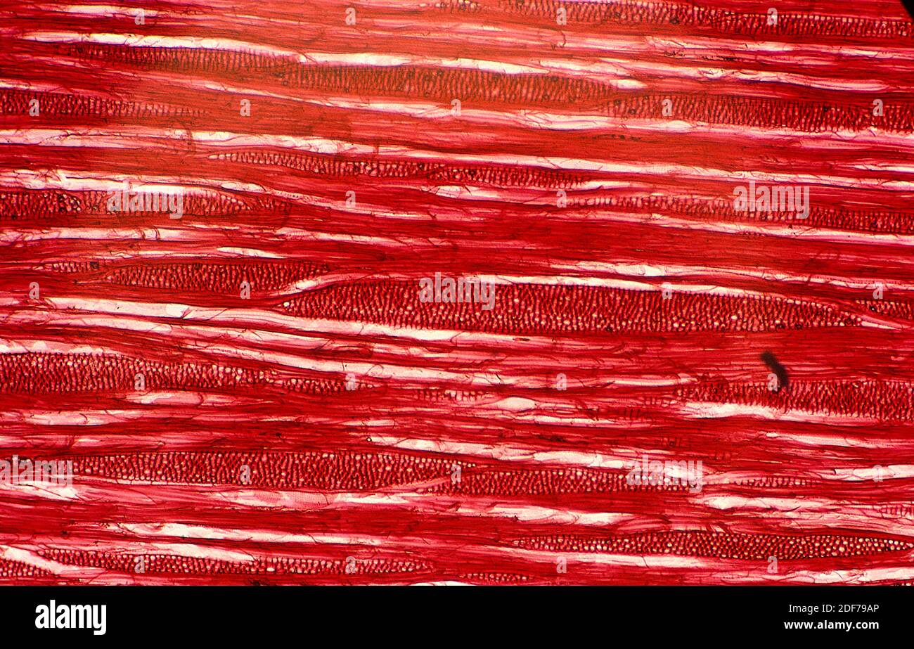 Las traqueidas son una especie de xilema. Fotomicrografía, sección longitudinal de la gimnosperma. Foto de stock