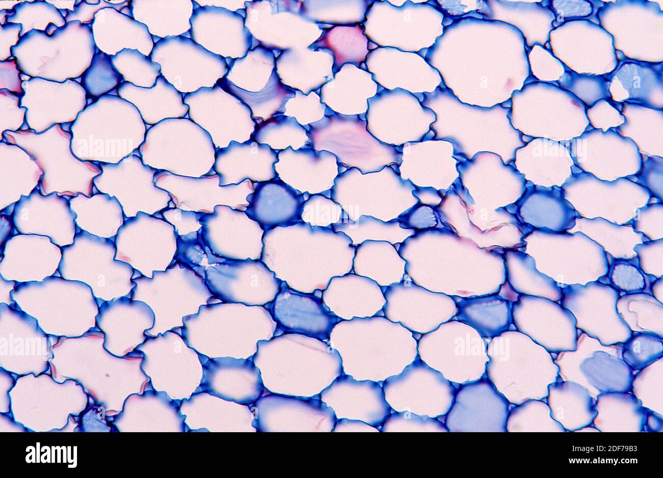 La plasmolisis es un proceso en el que las células pierden agua en una solución hipertónica. Fotomicrografía de tejido vegetal. Foto de stock