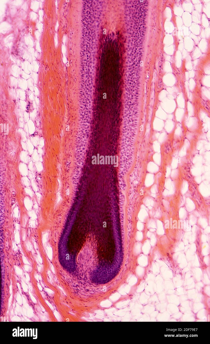 Folículos pilosos en la piel humana. Fotomicrografía. Foto de stock