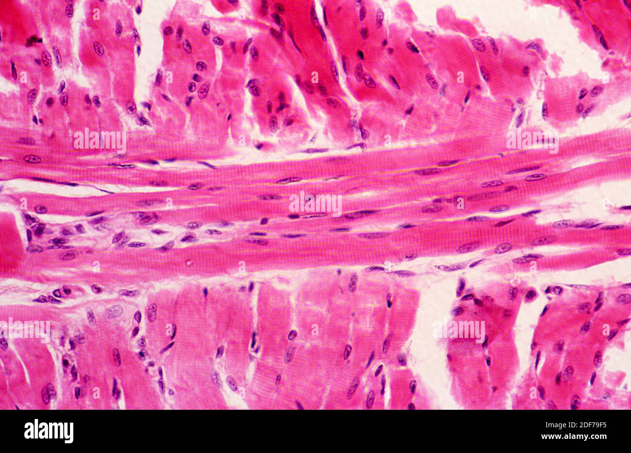 Músculo esquelético, sección longitudinal. Fotomicrografía. Foto de stock