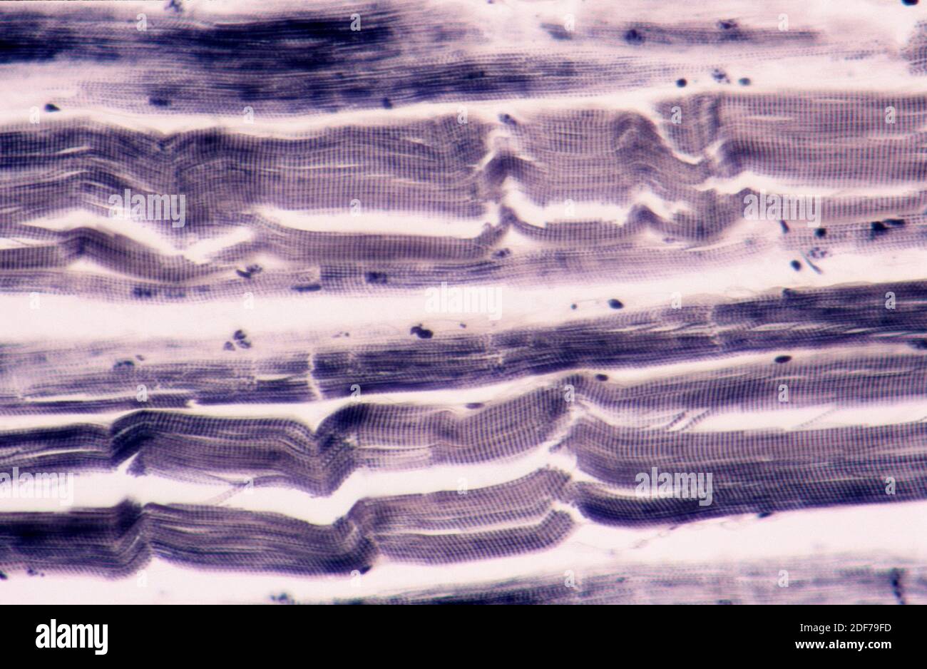 Músculo esquelético, sección longitudinal. Fotomicrografía. Foto de stock