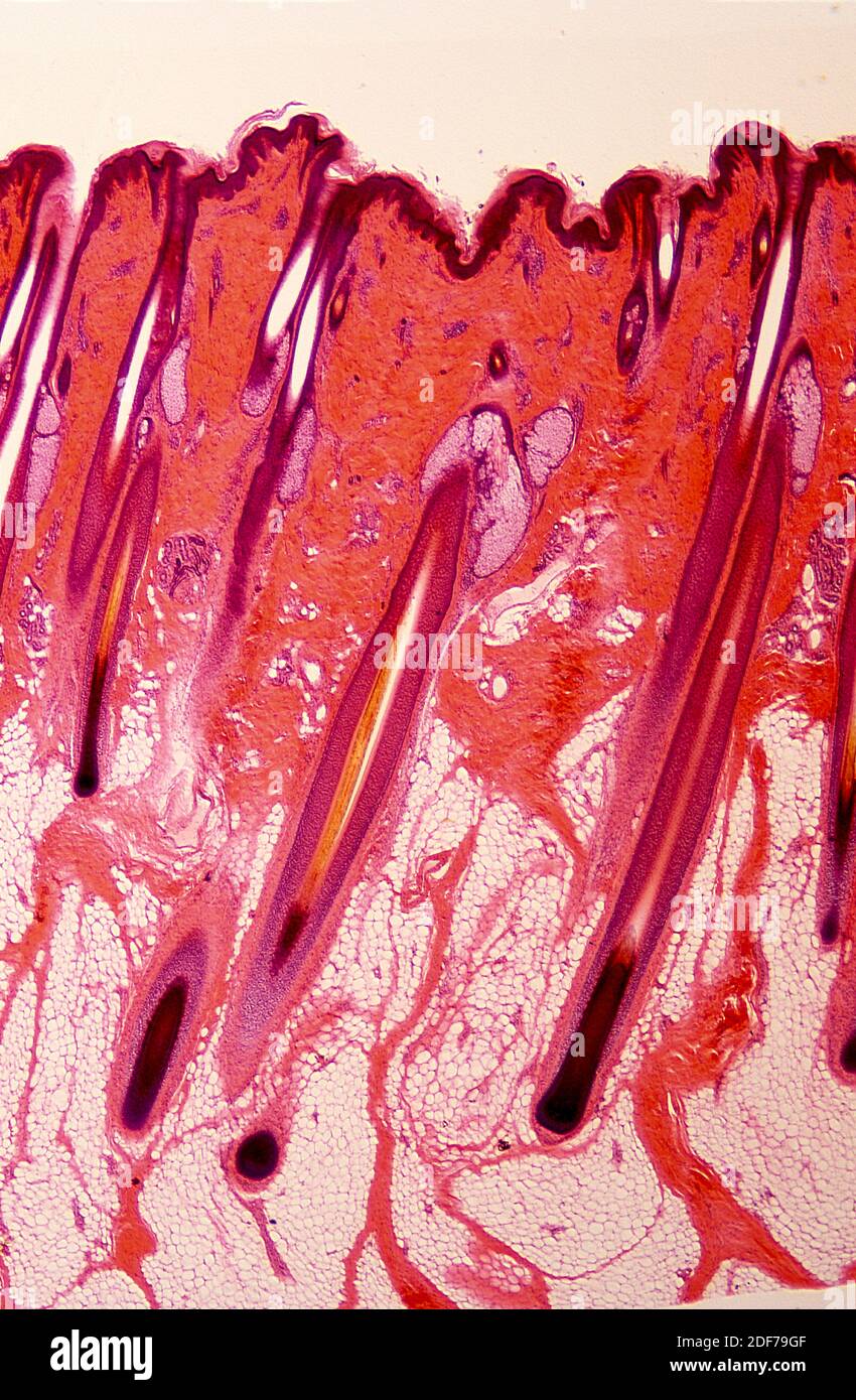 Folículos pilosos en la piel humana. Fotomicrografía. Foto de stock