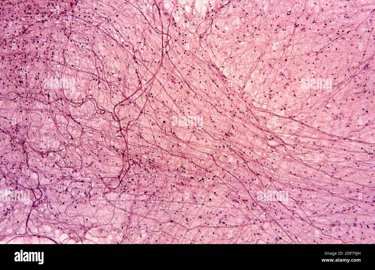 Axones de neuronas motoras. Fotomicrografía. Foto de stock