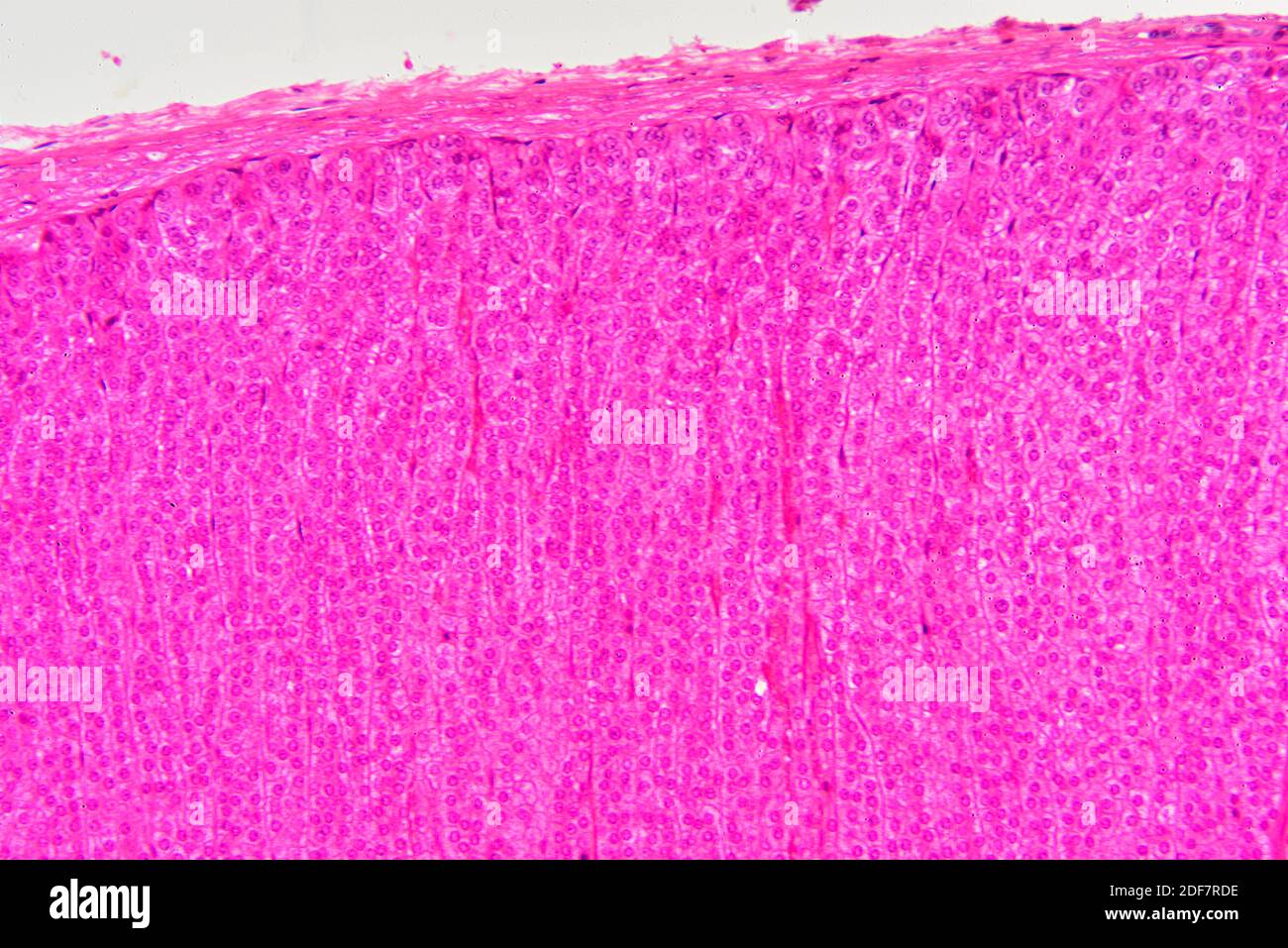 Sección de la glándula suprarrenal humana que muestra de arriba a abajo: Cápsula fibrosa, zona glomerulosa y zona fasciculata. Glándula suprarrenal humana o suprarrenal Foto de stock