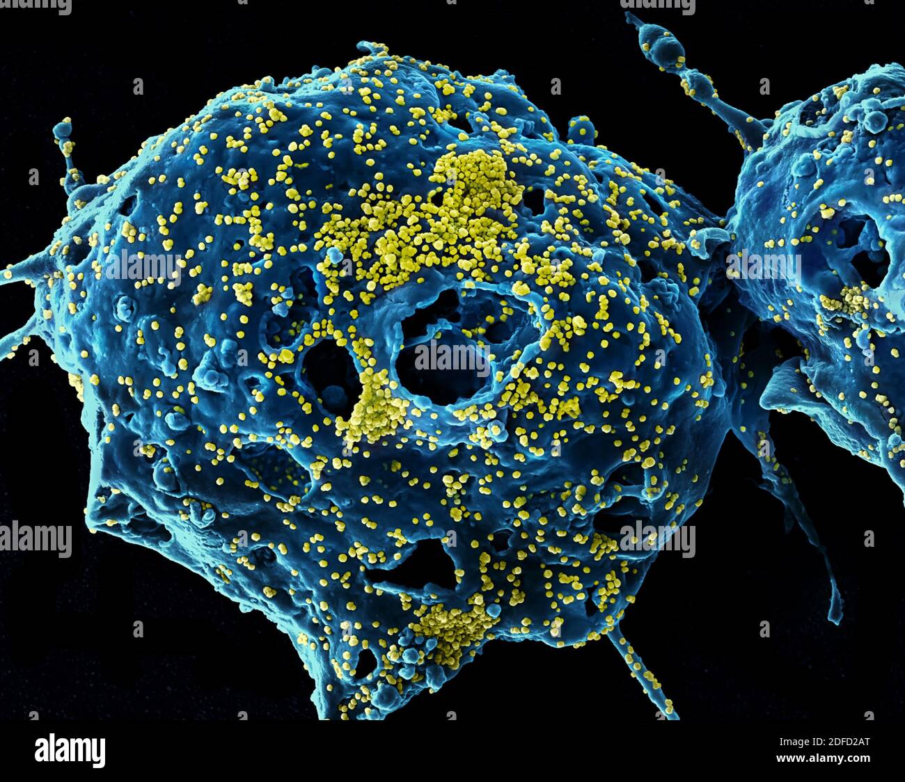 Micrografía Electrónica Coloreada Del Virus Del Síndrome Respiratorio De Oriente Medio 9948