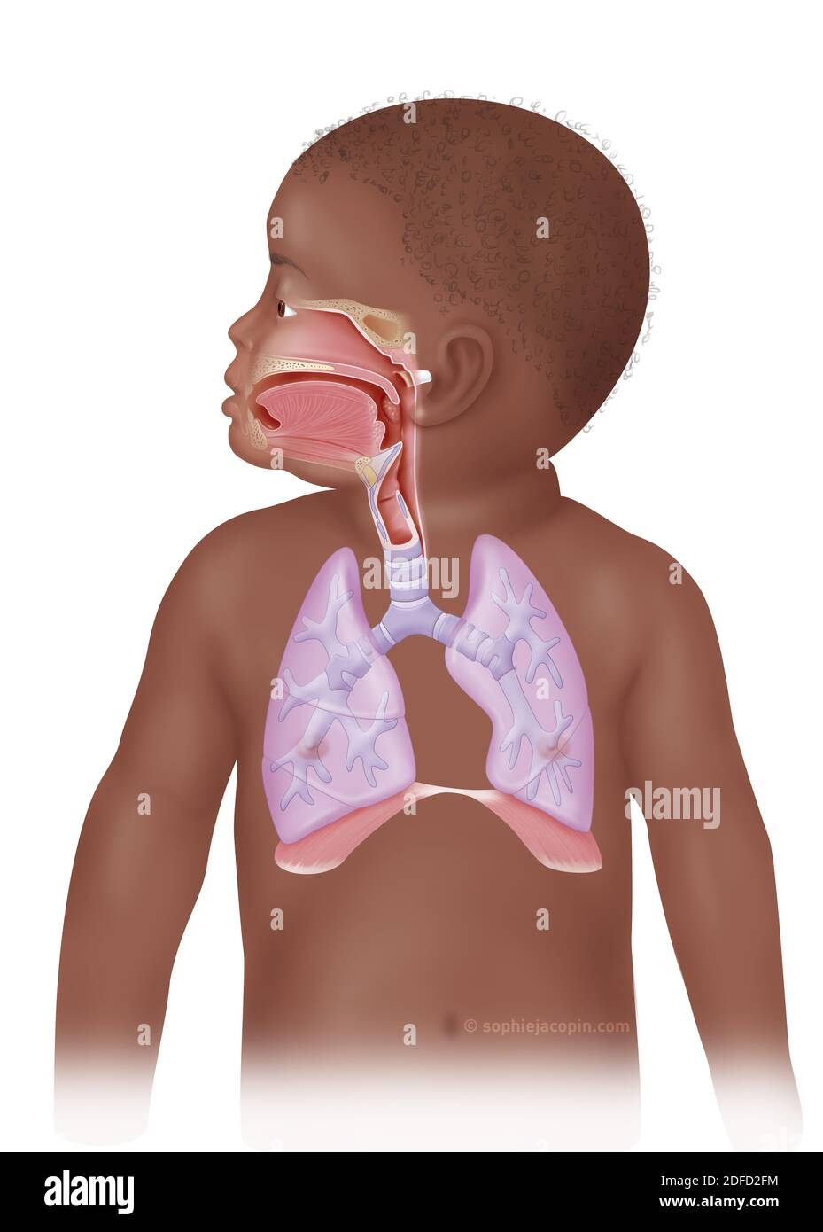 ENT y los niños del tracto pulmonar Foto de stock