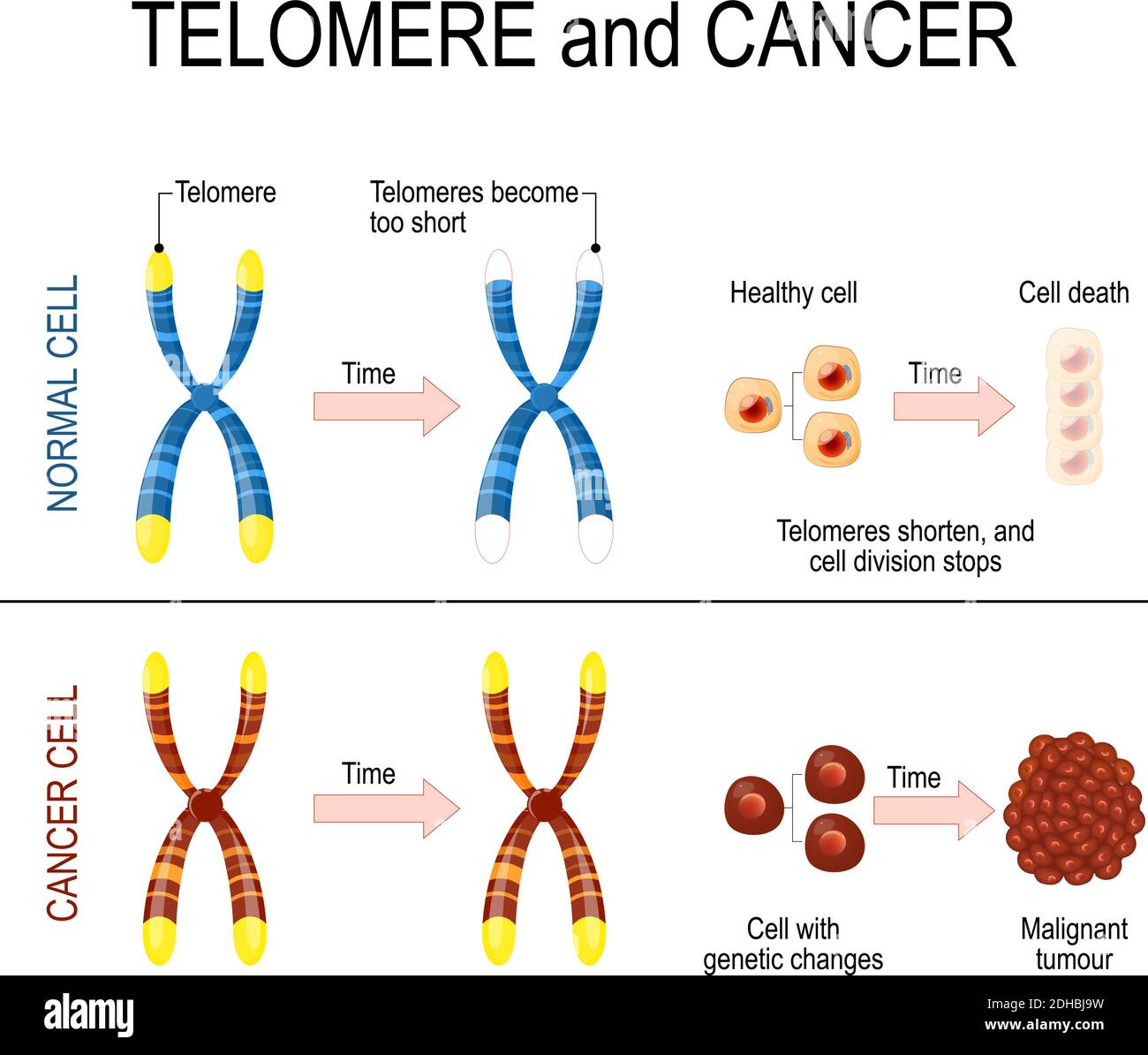 Cromosoma y telómero para células sanas y cancerosas. En una célula normal cada vez que una célula se divide, los telómeros se vuelven más cortos. En las células cancerosas Ilustración del Vector