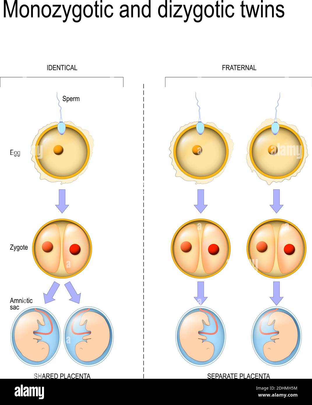 Diferencia y comparación del desarrollo del cigoto en gemelos monocigoticos  y dicigoticos Imagen Vector de stock - Alamy
