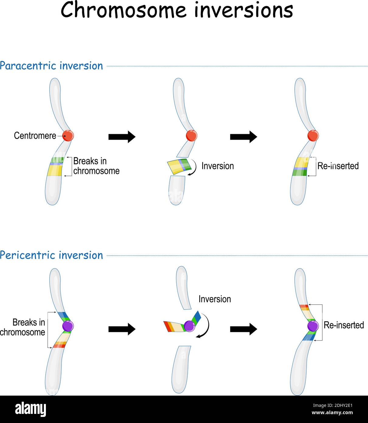 La inversión cromosómica ocurre cuando un solo cromosoma sufre la rotura y. reorganización dentro de sí misma Ilustración del Vector