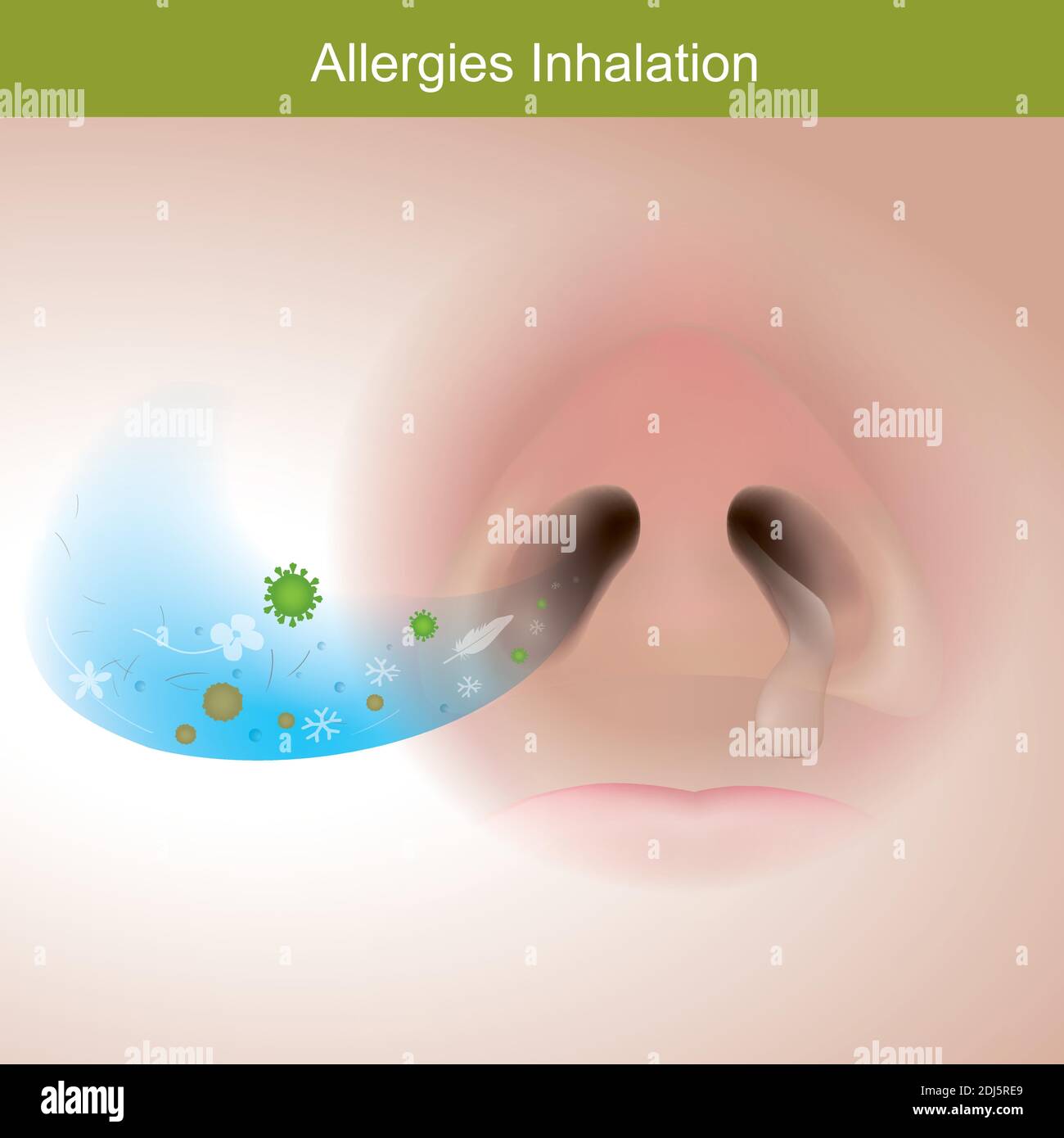 Alergias inhalación. La ilustración muestra cerca de la nariz humana por la reacción la respuesta del sistema inmune. Ilustración del Vector