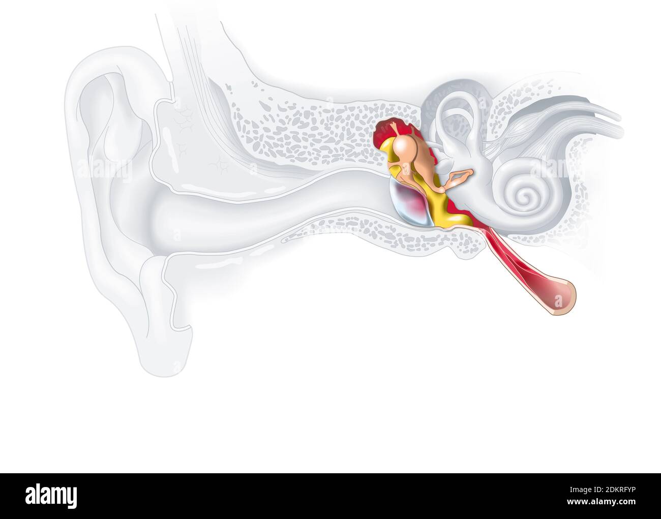 Ilustración médica que muestra inflamación del oído medio, otitis media Foto de stock