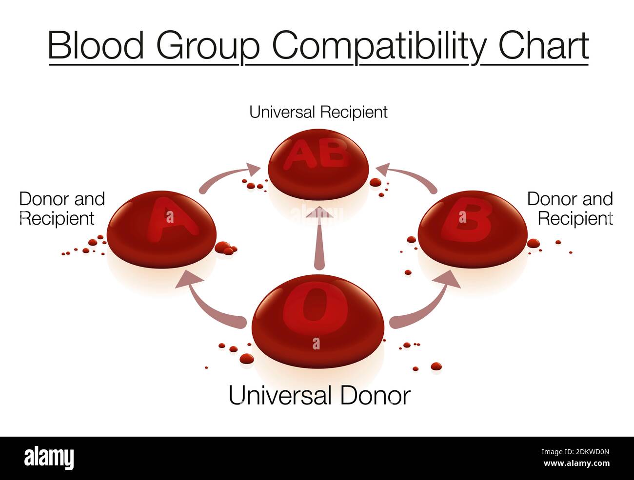 Cuadro de compatibilidad de grupos sanguíneos con el donante universal 0 y el receptor universal AB - en relación con la donación de sangre y la transfusión, representado con flechas. Foto de stock