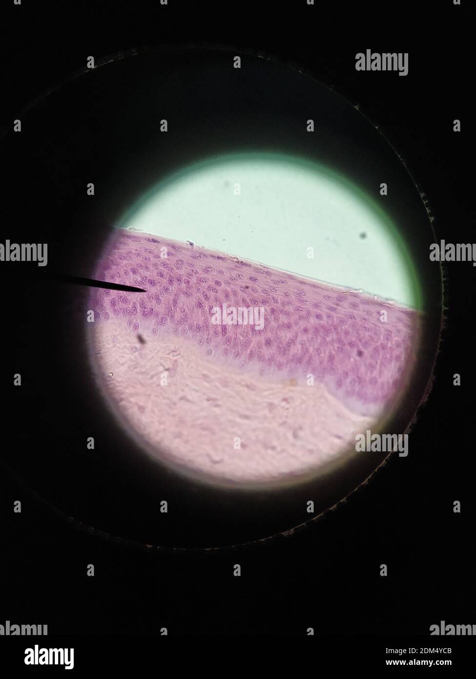 Piel humana microscopio optico fotografías e imágenes de alta resolución -  Alamy