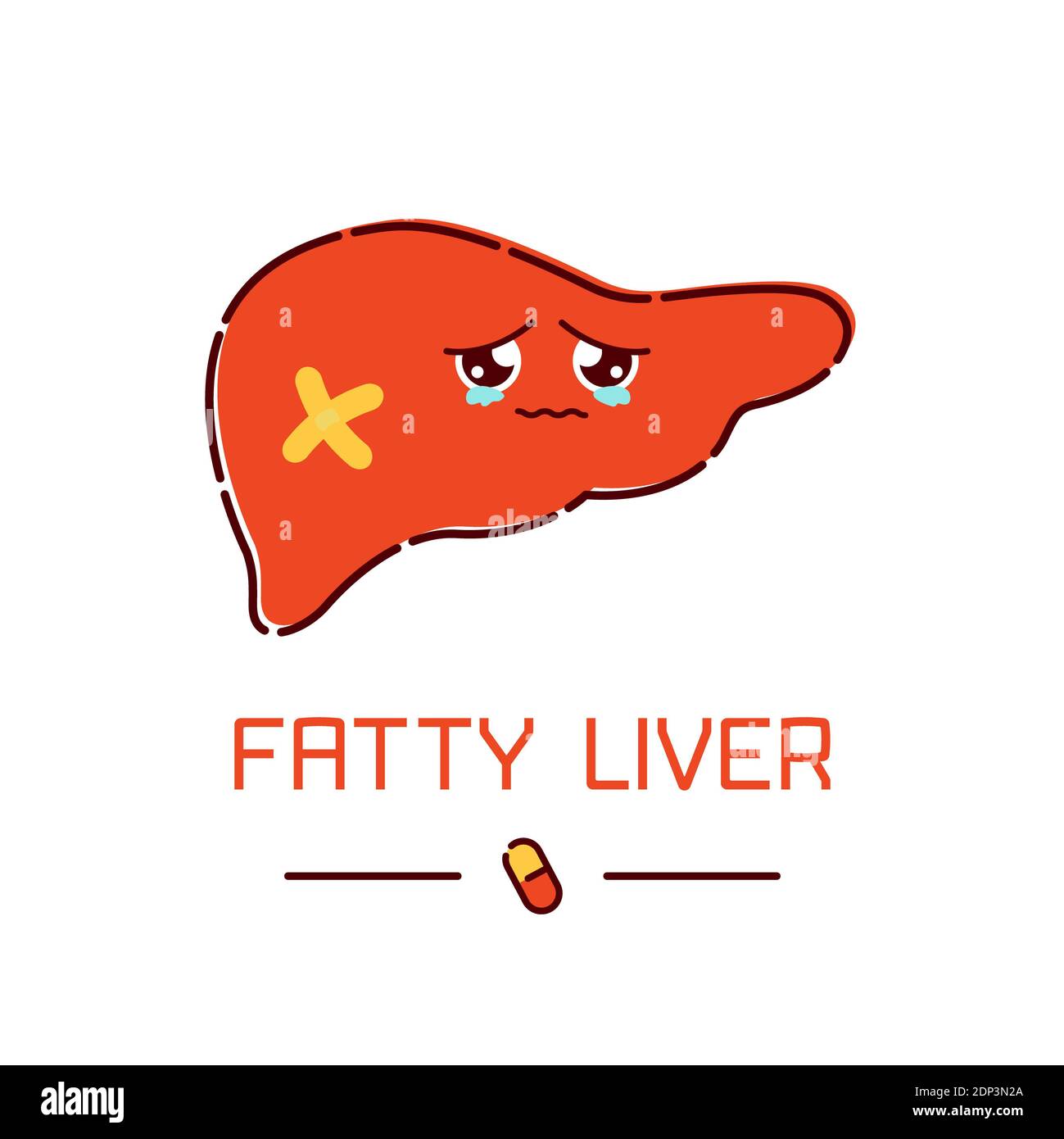 Hígado graso, ilustración conceptual. Foto de stock