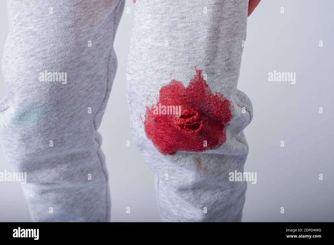 manchas de sangre sucias en la ropa de los niños. vida diaria manchas  sucias para lavar y limpiar el concepto Fotografía de stock - Alamy