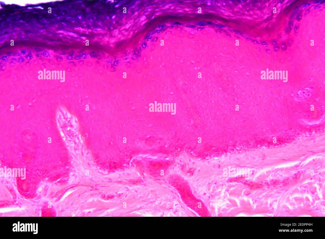 Piel humana que se muestra de arriba a abajo: Epidermis con estrato córneo, estrato granulosum, estrato spinosum, estrato basale y dermis. X125 a 10 cm Foto de stock