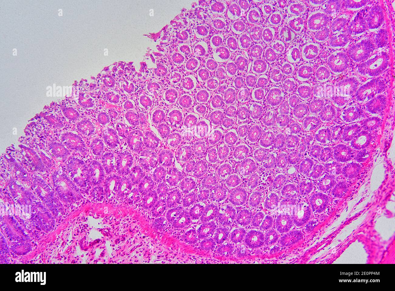 Recto humano mostrando de arriba a abajo: Mucosa con glándulas intestinales, lámina propria y submucosa. X75 a 10 cm de ancho. Foto de stock