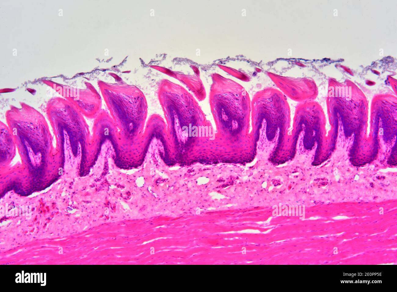 Histología De Papilas Foliadas