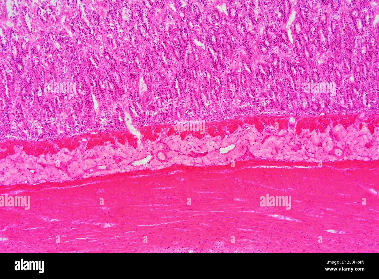 Intestino delgado humano (duodeno) mostrando de abajo a arriba: Fibras musculares, submucosa y mucosa con criptas de Lieberkhun. X75 a 10 cm de ancho. Foto de stock