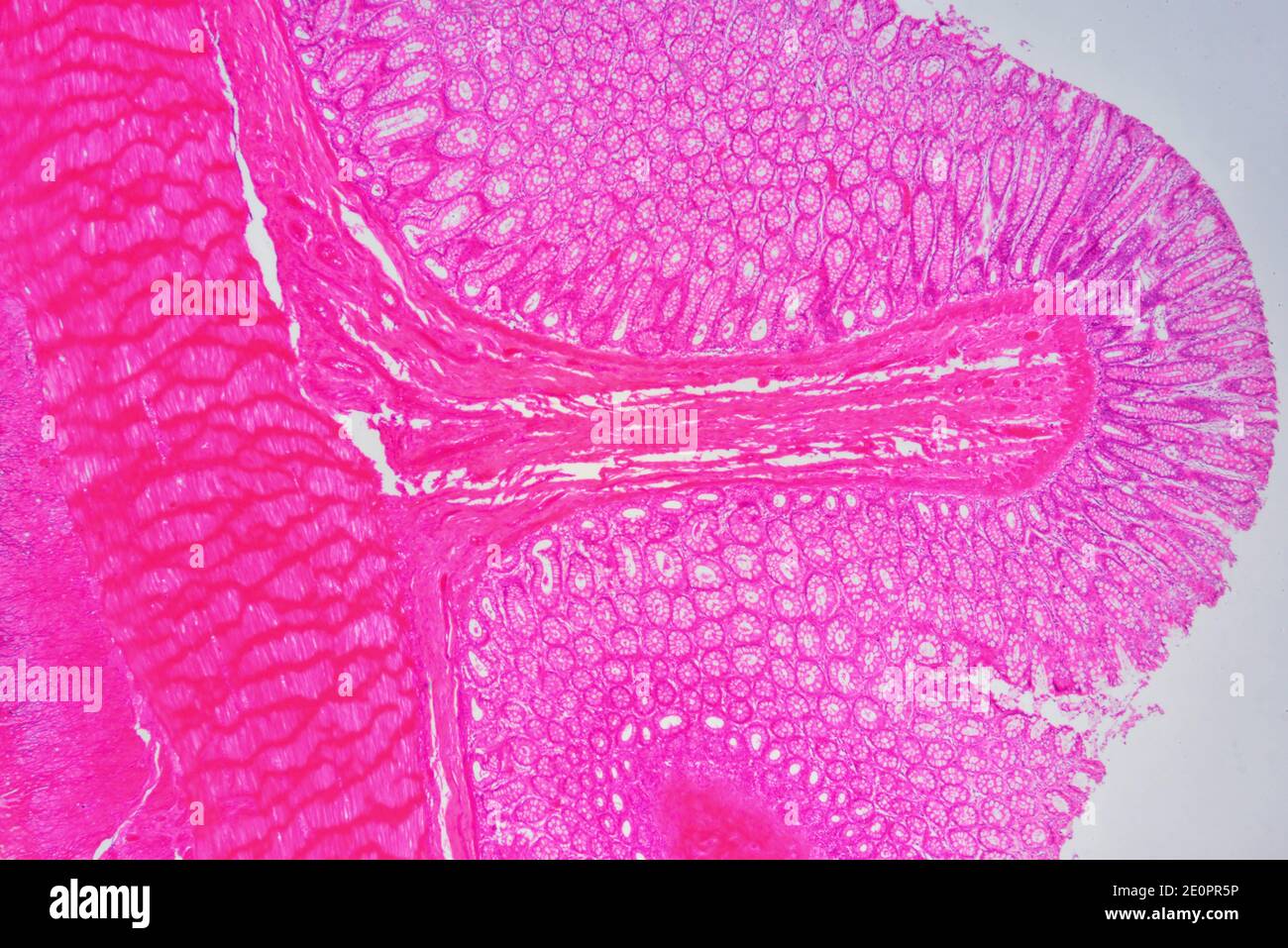 Intestino grueso humano (colon) mostrando de izquierda a derecha: Capas musculares, submucosa y mucosa con criptas de Lieberkhun. X25 a 10 cm de ancho. Foto de stock