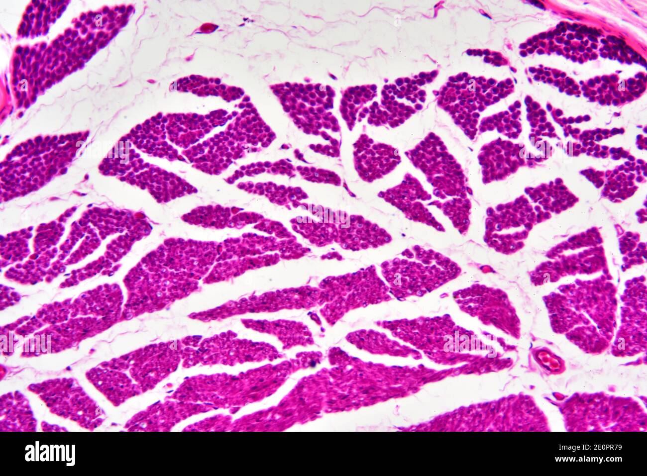Fibras nerviosas humanas con fascículos axones. X125 a 10 cm de ancho. Foto de stock